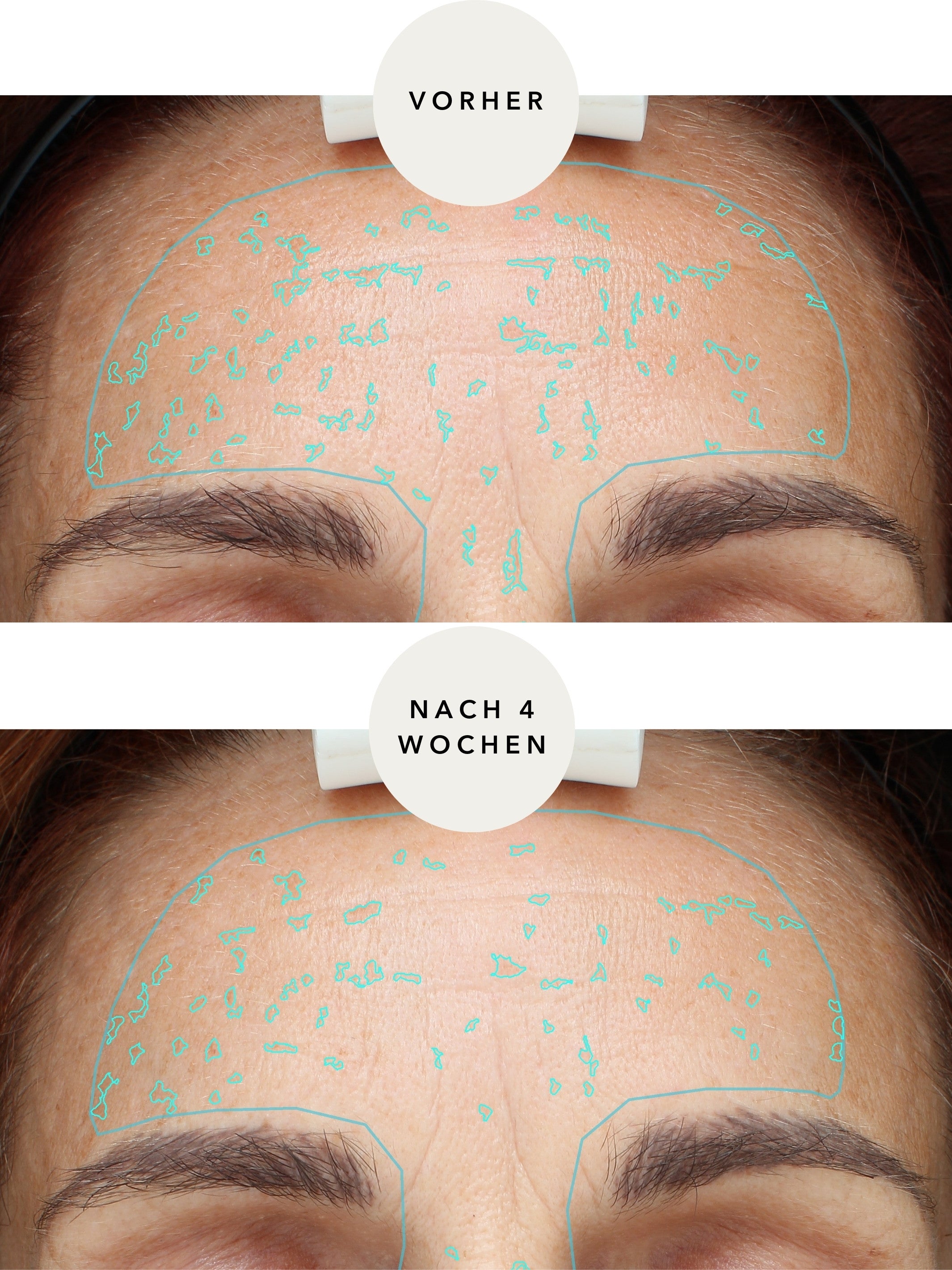 XTREME Brightening Booster
