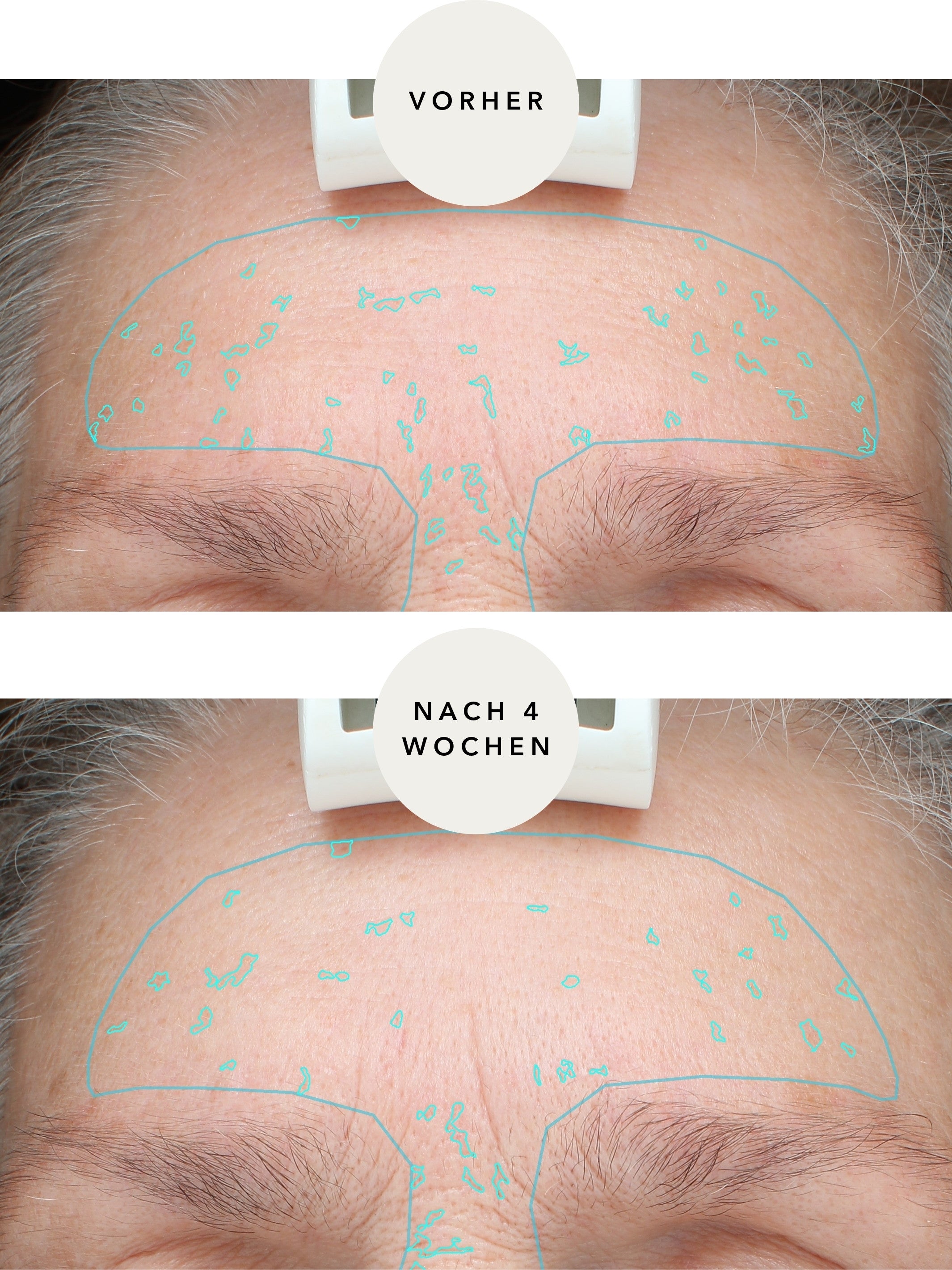 Anti-verouderingsvlekken nachtverzorging