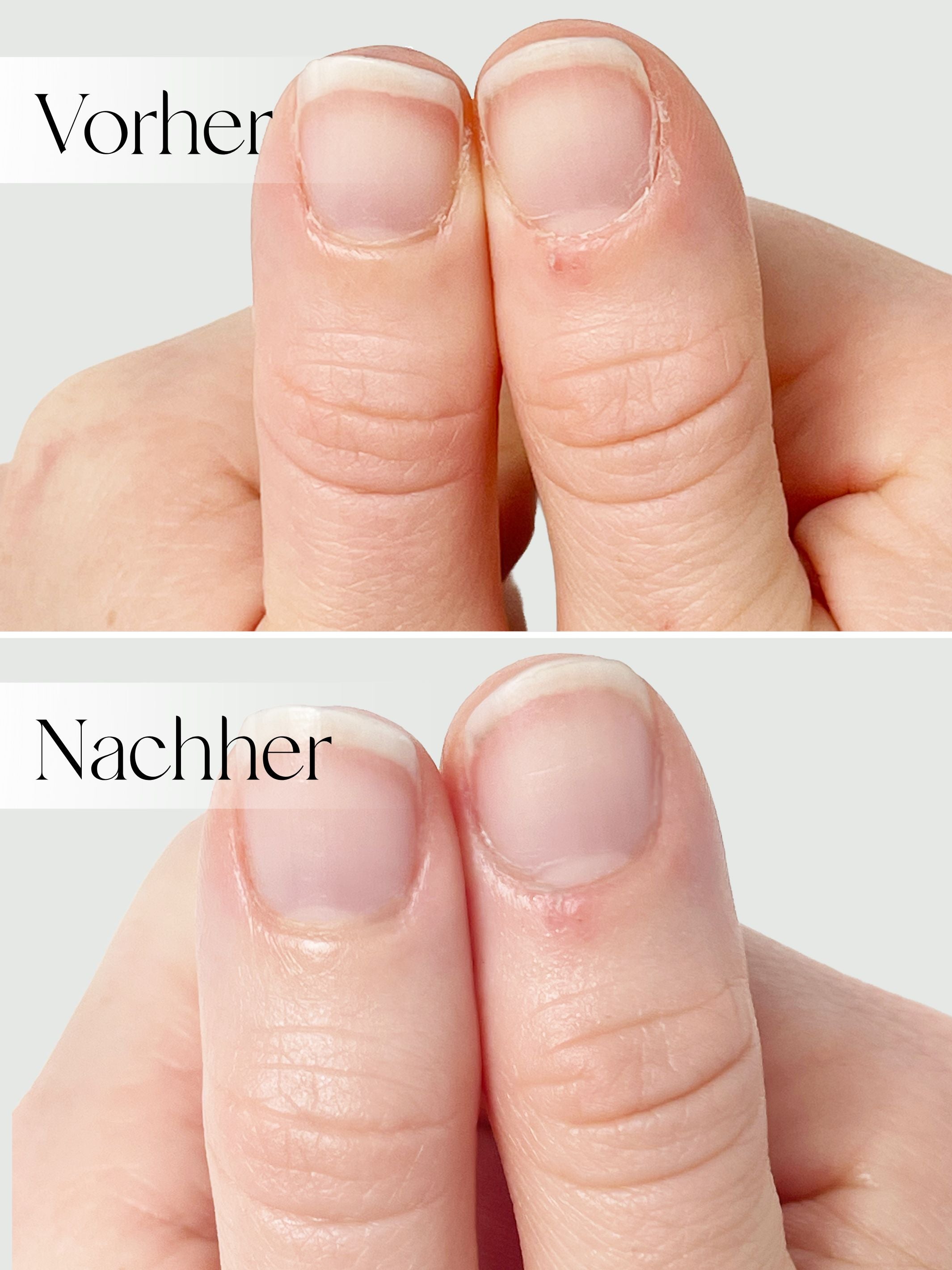 Anti-Flecken Handmaske
