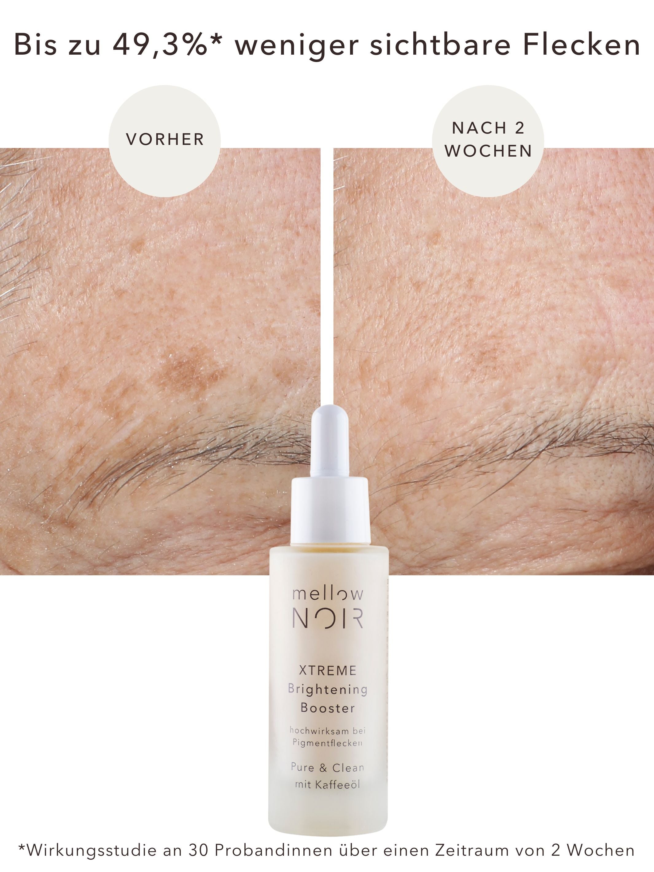 Anti-verouderingsvlekken nachtverzorging